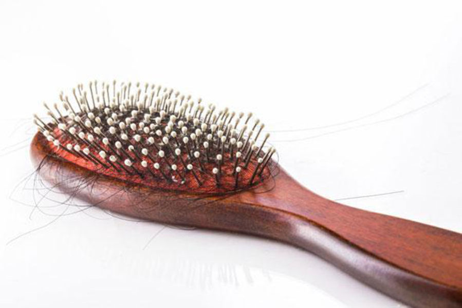 homeopathic-hair-fall-treatment